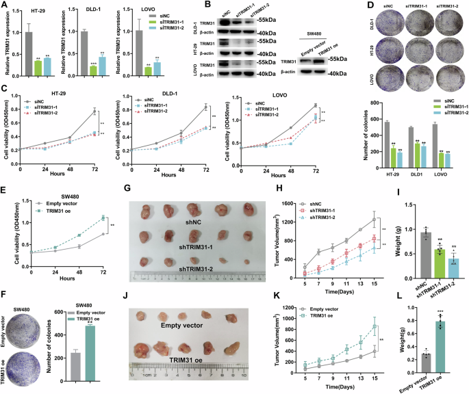 Fig. 2: Knockdown of TRIM31 inhibits CRC proliferation in vitro and in vivo.