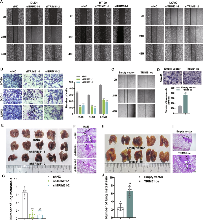 Fig. 3: Knockdown of TRIM31 inhibits CRC metastasis in vitro and in vivo.