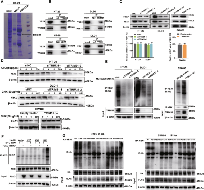 Fig. 4: TRIM31 maintains YBX1 protein stability by catalyzing lysine 81 and 52 sites K63 ubiquitination.