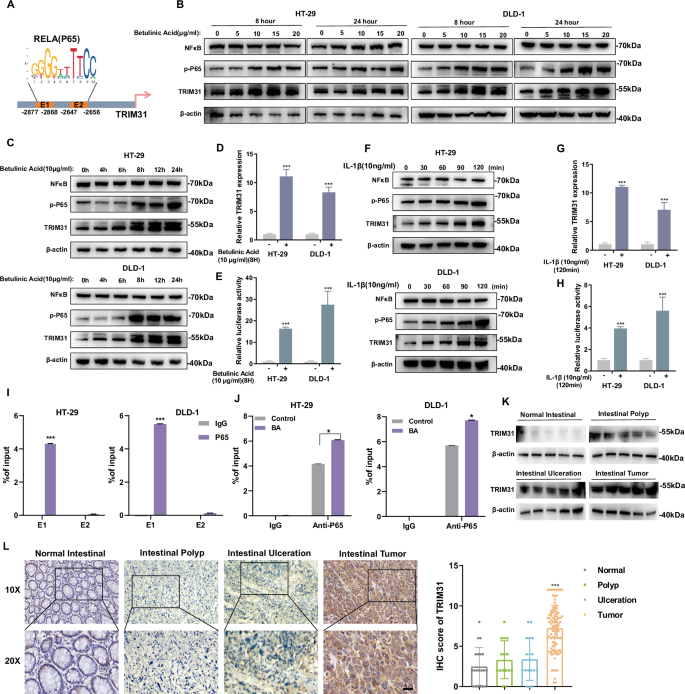 Fig. 7: Activated NF-κB promotes the transcription of TRIM31 in CRC cells.