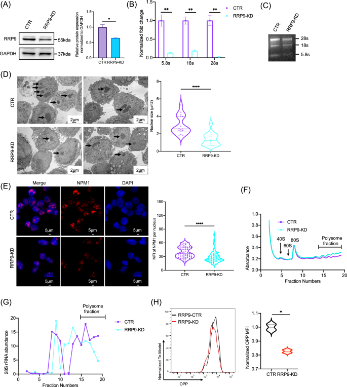 Fig. 6: RRP9 regulates ribosome biogenesis in AML cells.
