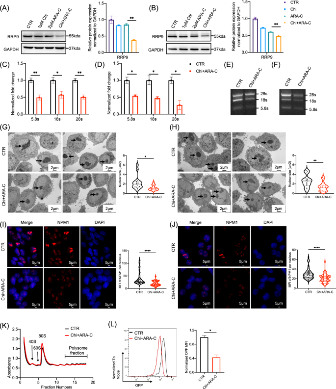 Fig. 7: Chidamide combined with cytarabine inhibits ribosome biogenesis in AML cells by downregulating RRP9.