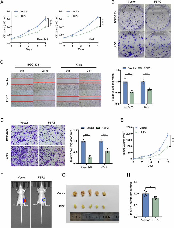 Fig. 3: Inhibition of malignant biological behaviors of GC cells by FBP2 in vitro and in vivo.
