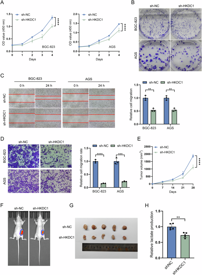 Fig. 6: Inhibition of malignant biological behaviors of GC cells by sh-HKDC1 in vitro and in vivo.