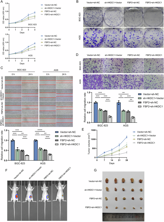 Fig. 8: The synergistic inhibitory effect of FBP2 and sh-HKDC1 on the malignant biological behavior of GC cells in vitro and in vivo.