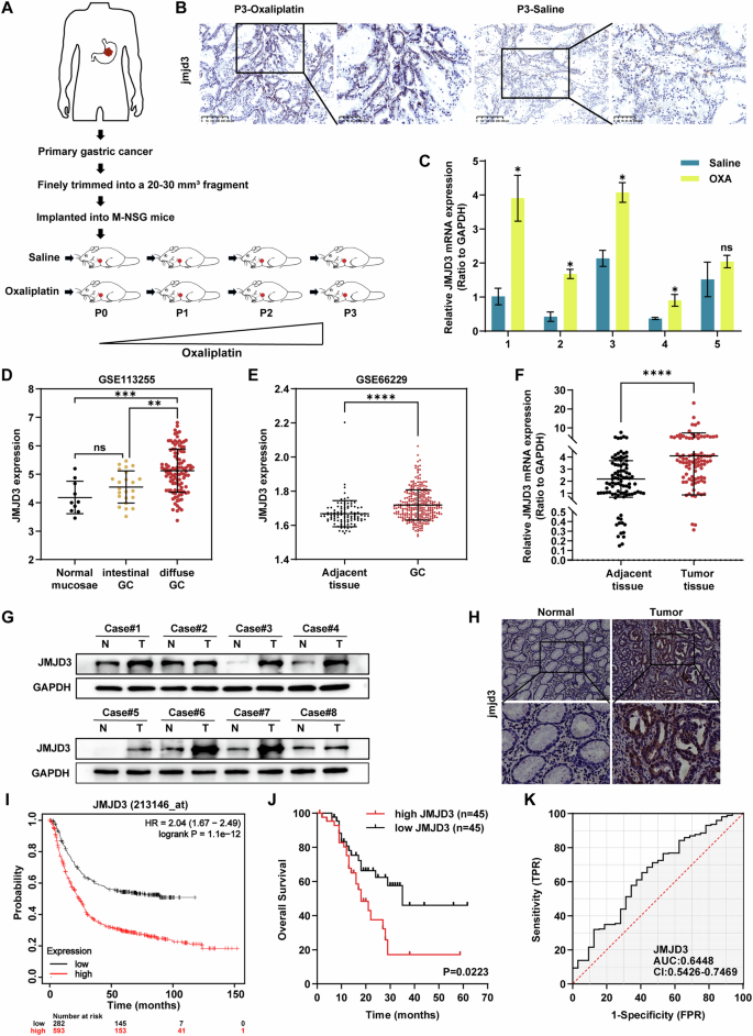 Fig. 1: JMJD3 is upregulated in gastric cancer and predicts shorter survival.