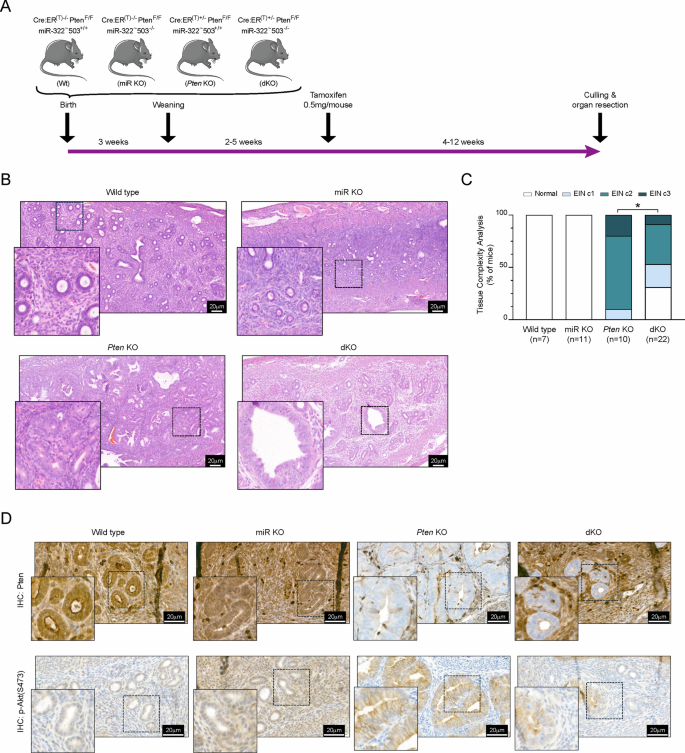 Endometrial cancer progression driven by PTEN-deficiency requires miR ...