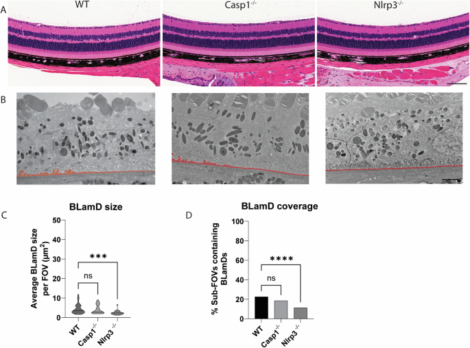Fig. 10: Nlrp3 deficiency protects mice from spontaneous BLamD deposit formation.