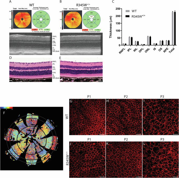 Fig. 1: No gross structural changes in the retina or RPE are observed in WT vs. R345W+/+ mice even at ≥20 months of age.