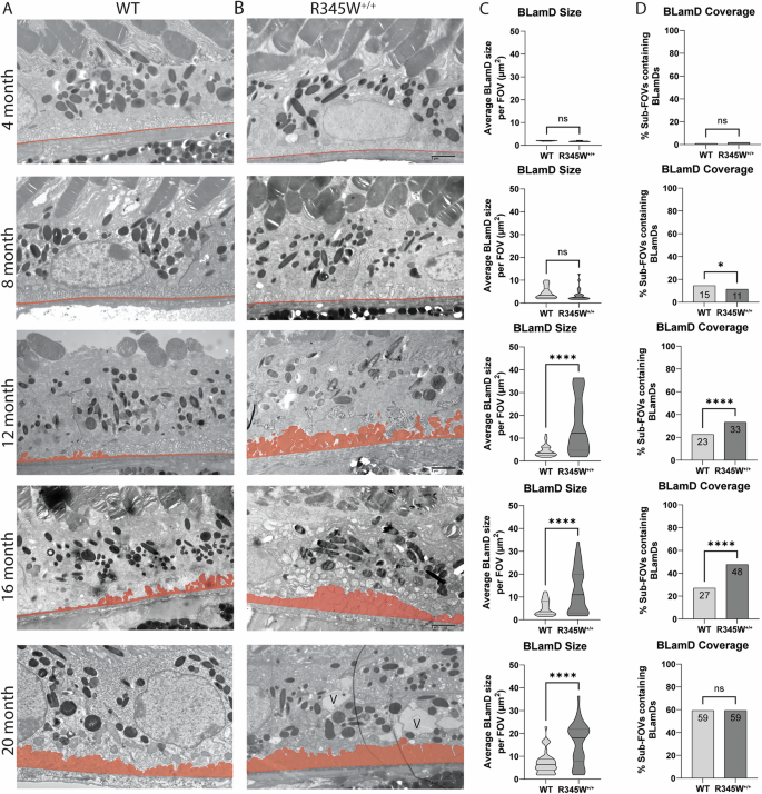 Fig. 2: Quantitative, longitudinal transmission electron microscopy (TEM) delineates basal laminar deposit (BLamD) progression in WT and R345W+/+ mice.