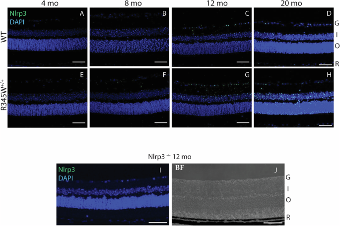 Fig. 4: Increased Nlrp3 expression observed in aging R345W+/+ mouse retina compared to WT mice.