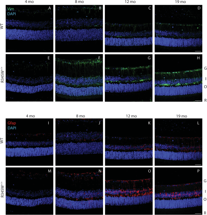 Fig. 5: Muller glia driven gliosis is evident in aging R345W+/+ mice compared to WT.