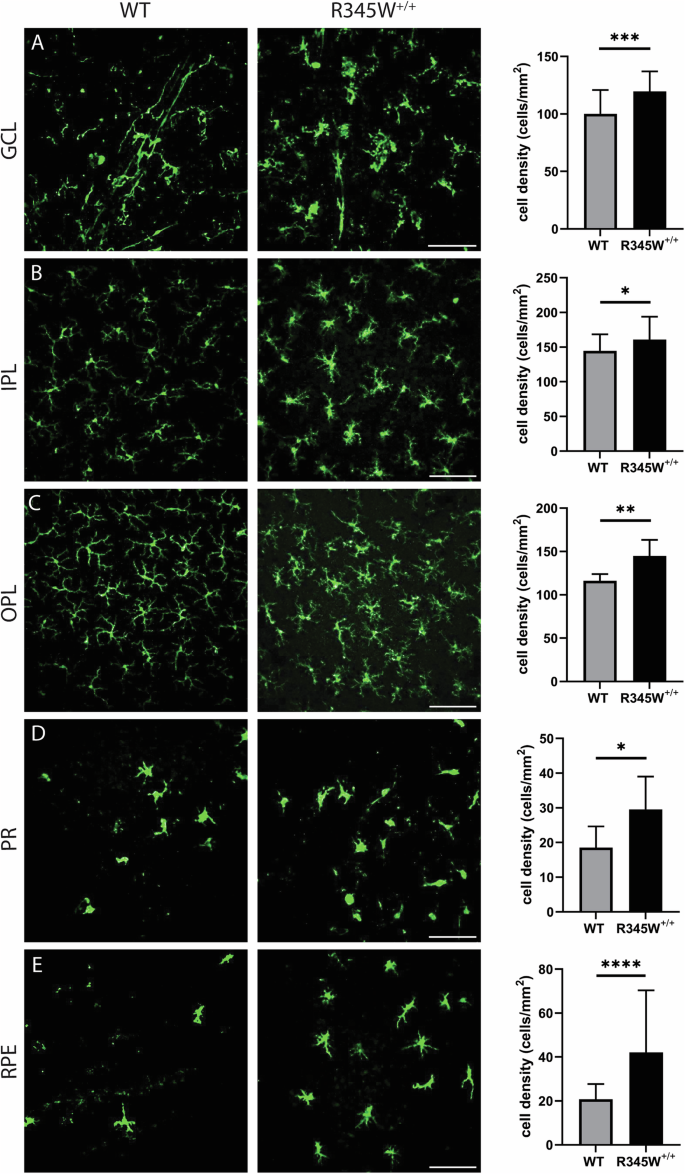 Fig. 6: Microglia activation associated hypertrophy and proliferation observed in R345W+/+ mice compared to WT at 20 month.