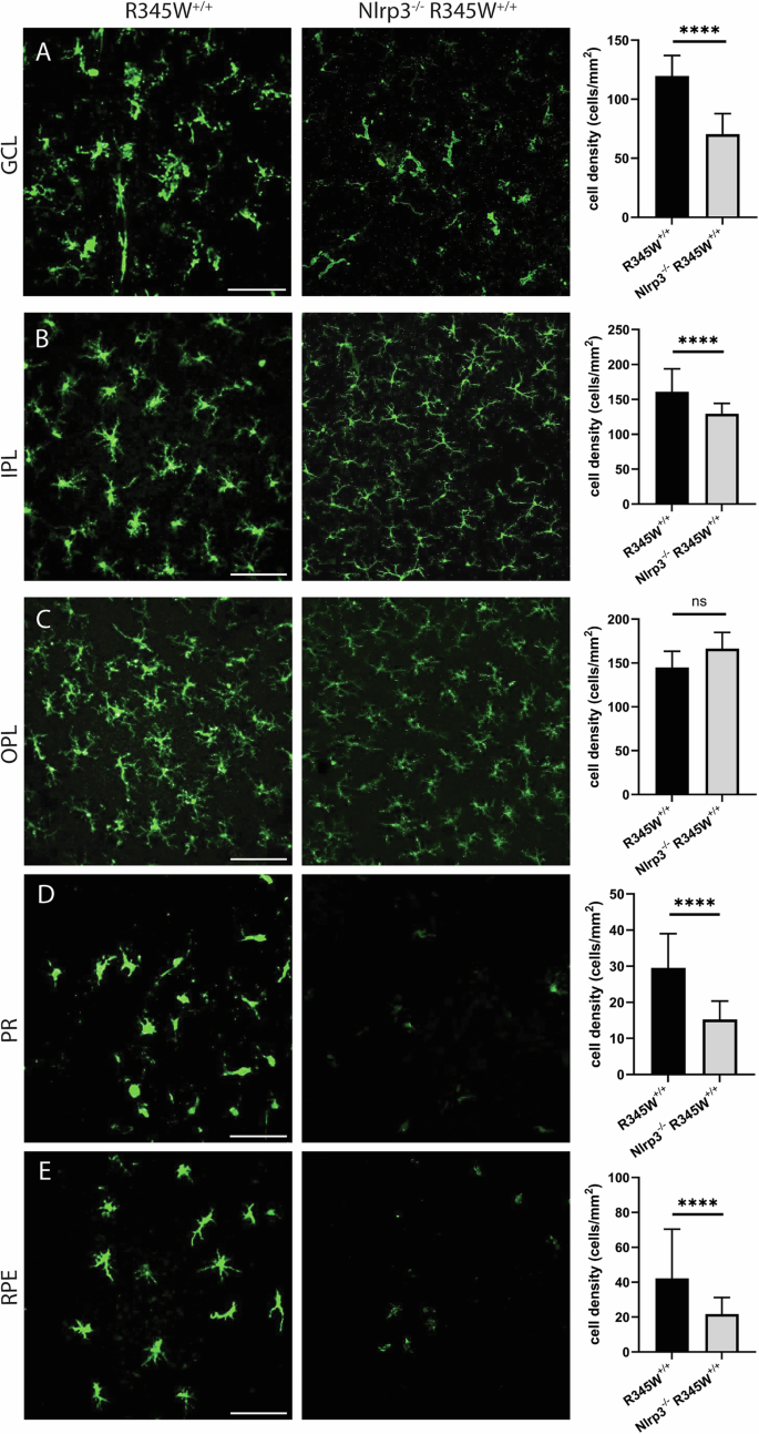 Fig. 9: Microglia activation-associated hypertrophy and proliferation due to the R345W mutation is prevented in Nlrp3 deficient mice.