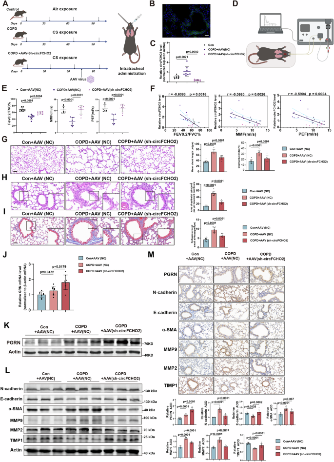 Fig. 6: circFCHO2 knockdown reverses cigarette smoke-induced emphysema and airway remodeling in COPD mice.