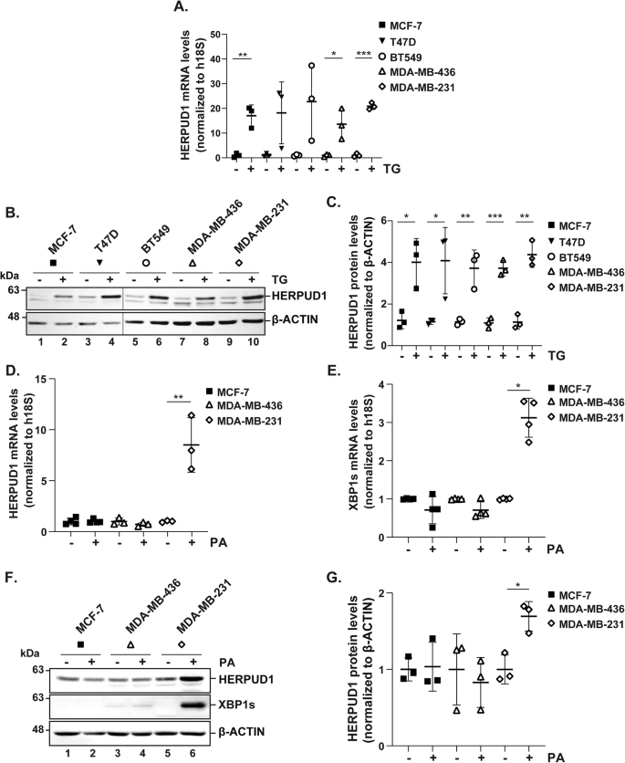 Fig. 2: HERPUD1 protein levels increase in all breast cancer cell lines in response to TG, while PA-induced HERPUD1 upregulation is restricted to the highly aggressive TNBC cell line MDA-MB-231.