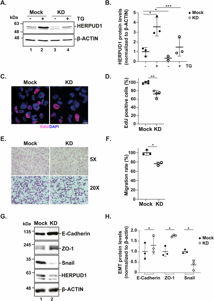 Fig. 3: HERPUD1 silencing in MDA-MB-231 cells reduces cell proliferation, migration and the mesenchymal phenotype.