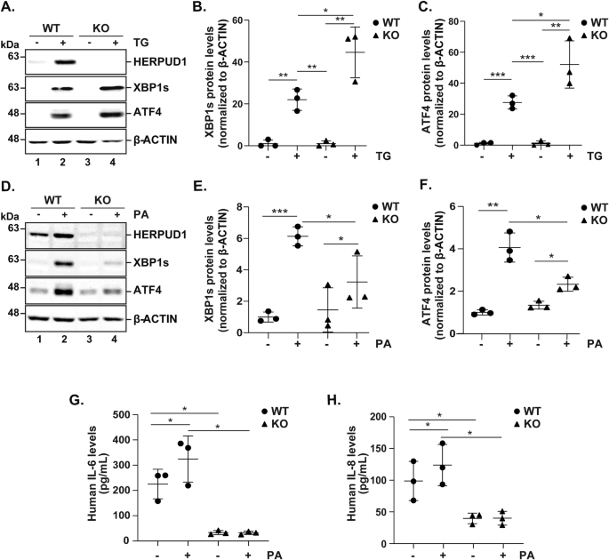 Fig. 7: HERPUD1 differentially regulates UPR signaling depending on the type of stress stimulus and inflammatory cytokine secretion.