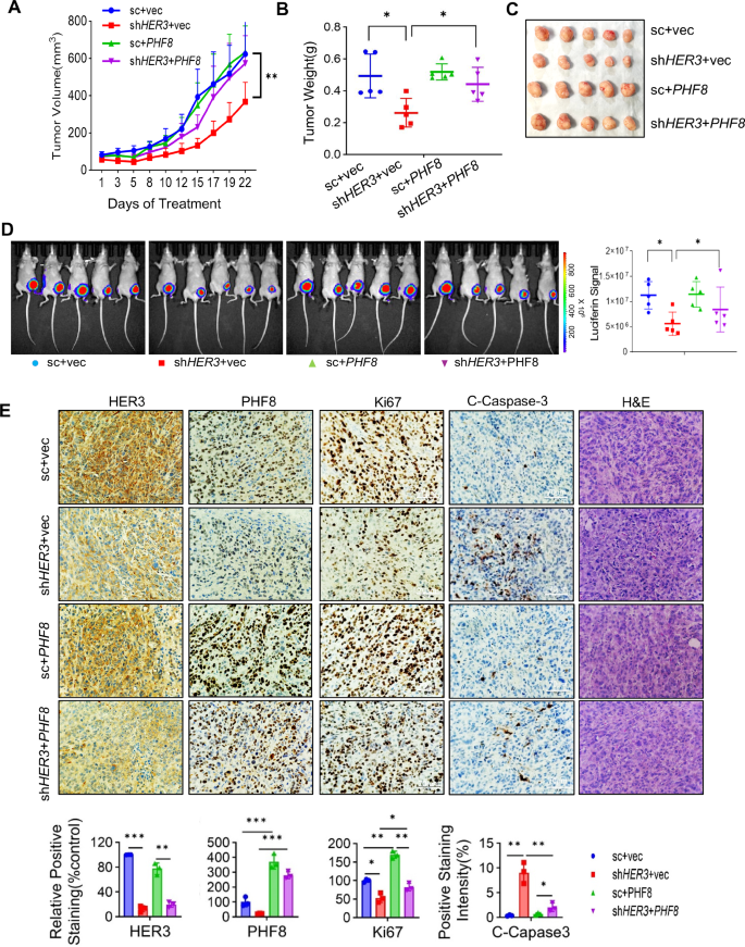 Fig. 4: Ectopic expression of PHF8 significantly attenuates the inhibitory effects of HER3 depletion on TNBC tumor growth in orthotopic tumor models.