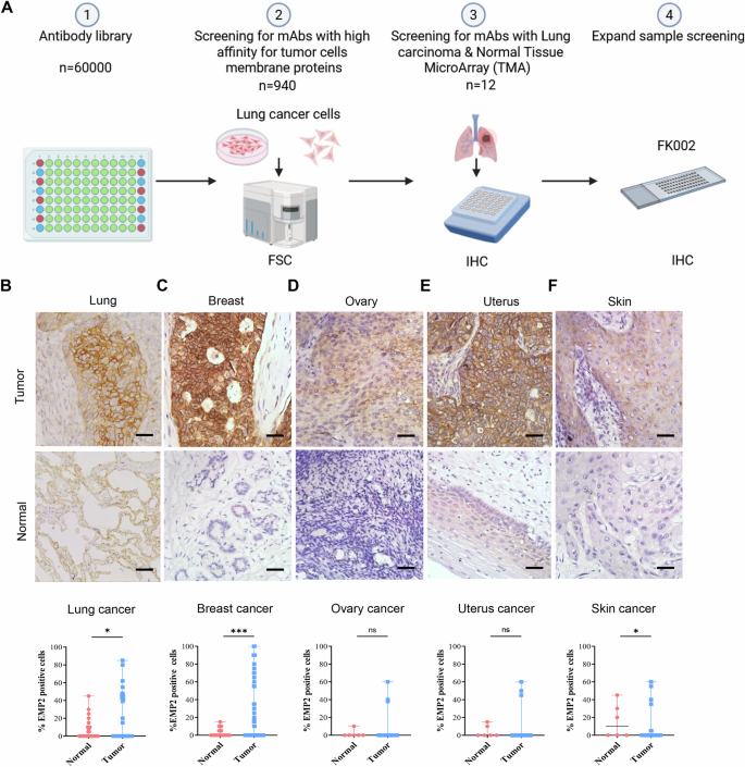 Fig. 1: Target antigen of FK002 is overexpressed in various human tumors.