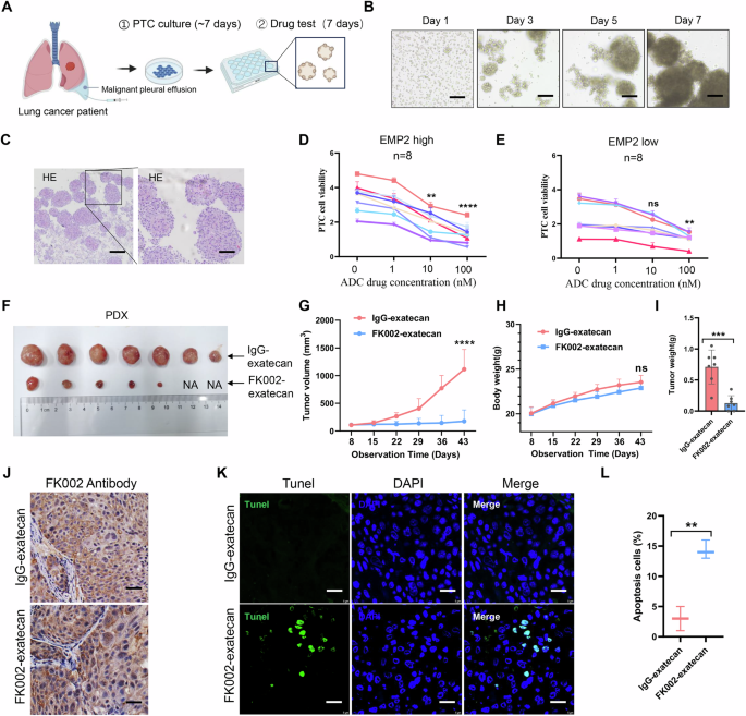 Fig. 6: Antitumor activity of FK002-exatecan on patient-derived microtumors and patient-derived xenografts.