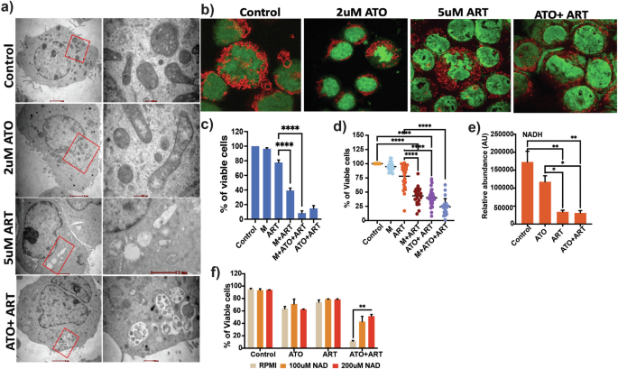 Fig. 3: ART disrupts the mitochondrial dynamics and architecture of AML cells.