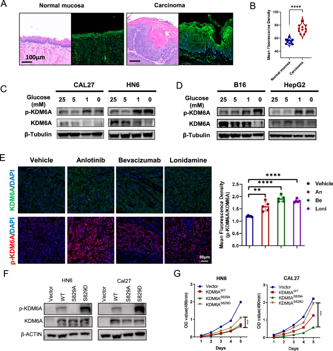 Fig. 2: KDM6A-pSer829 promotes tumor proliferation.