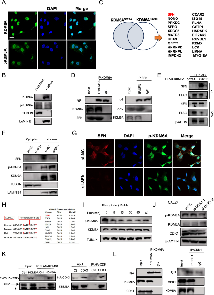 Fig. 3: KDM6A is phosphorylated by CDK1 and transported out of the nucleus.