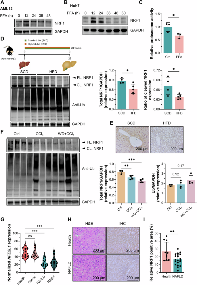 Fig. 1: Decreased hepatic NRF1 expression and reduced proteasomal activity in MASH patients and models.