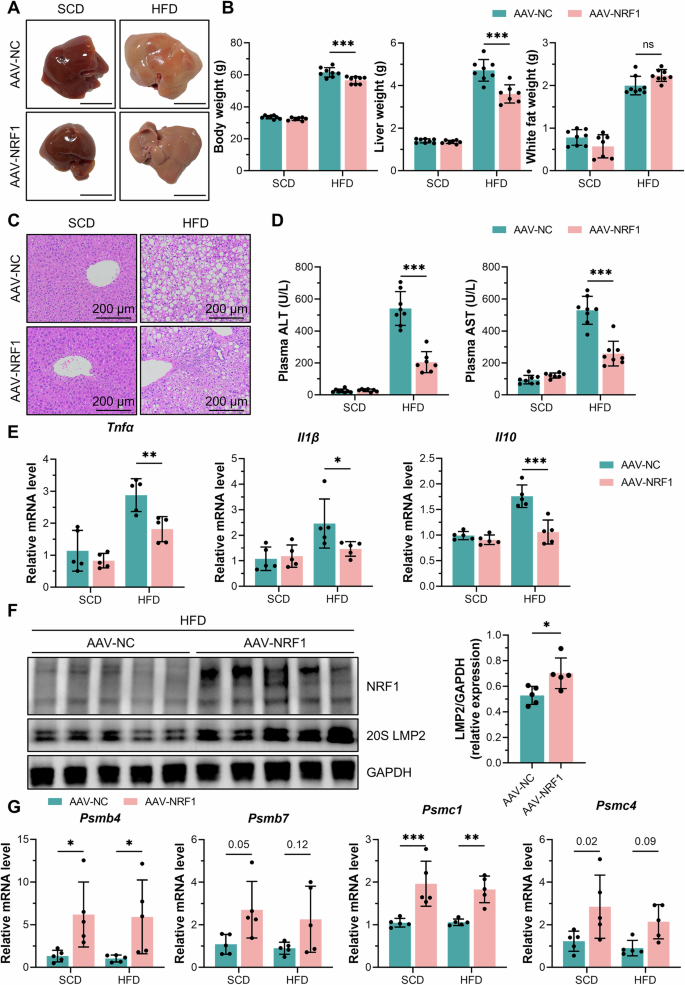 Fig. 2: Liver-specific NRF1 overexpression ameliorated MASH in mice.