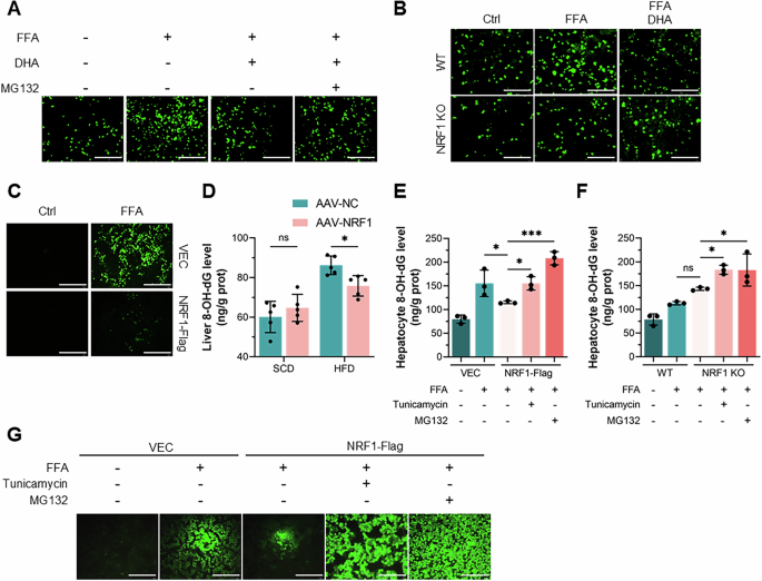 Fig. 7: NRF1 alleviated oxidative stress in MASH by inhibiting ER stress.