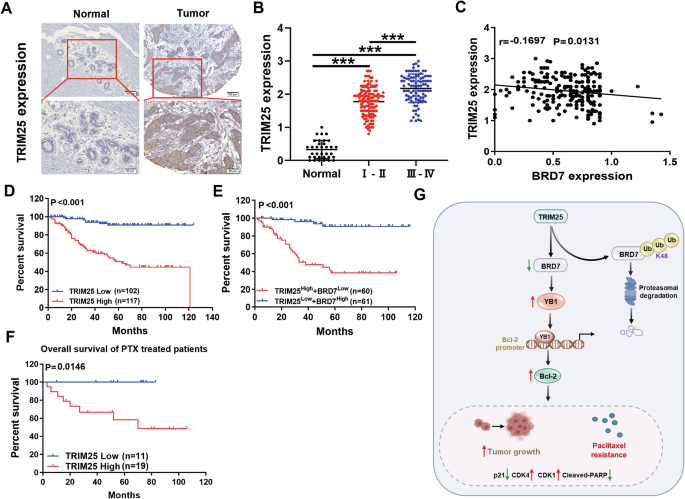 Fig. 8: The predictive value of TRIM25 and BRD7 for the prognosis and diagnosis of clinical breast cancer tissues.
