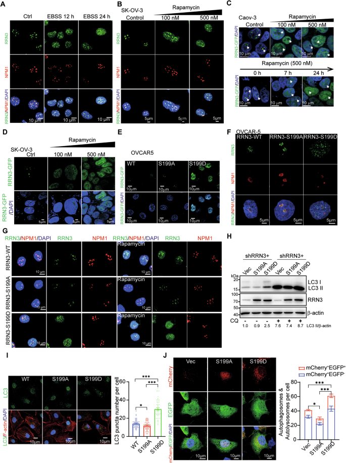 Fig. 4: Nutrient stress diverts RRN3 out of nucleolus by phosphorylation at S199 residue.