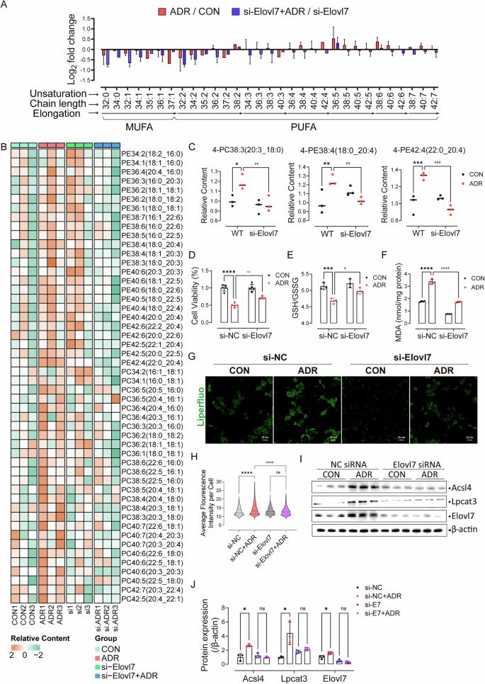 Fig. 5: Elovl7 knockdown mitigated the elevation of LC-PUFA-PLs in injured podocytes and reduced podocyte ferroptosis.
