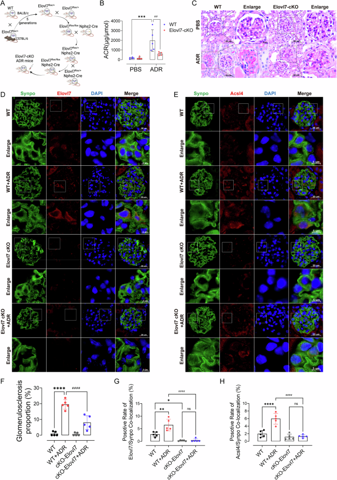 Fig. 6: Conditional knockout of Elovl7 alleviated podocyte injury.