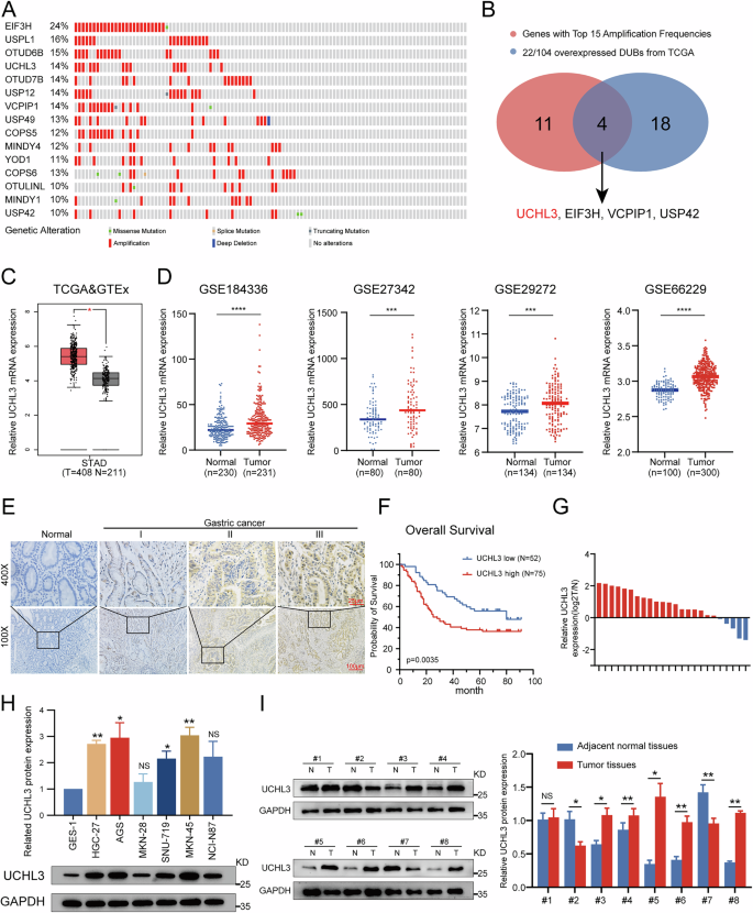 Fig. 1: UCHL3 is overexpressed in GC and correlates with poor prognosis.