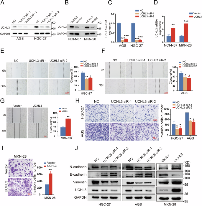 Fig. 2: UCHL3 enhances invasion, migration, and EMT in GC cells.