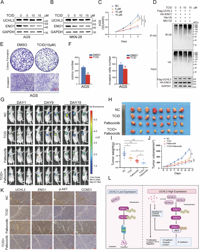 Fig. 8: TCID suppresses UCHL3 function, and increases GC cell sensitivity to CDK4/6 inhibitors.