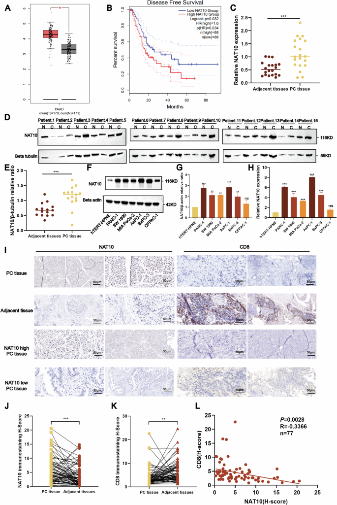 Fig. 1: NAT10 is highly expressed in pancreatic cancer and inhibits immune cell infiltration.