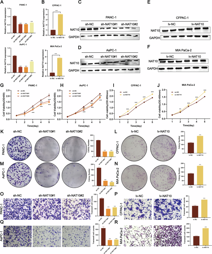 Fig. 2: NAT10 promotes pancreatic cancer proliferation and metastasis.