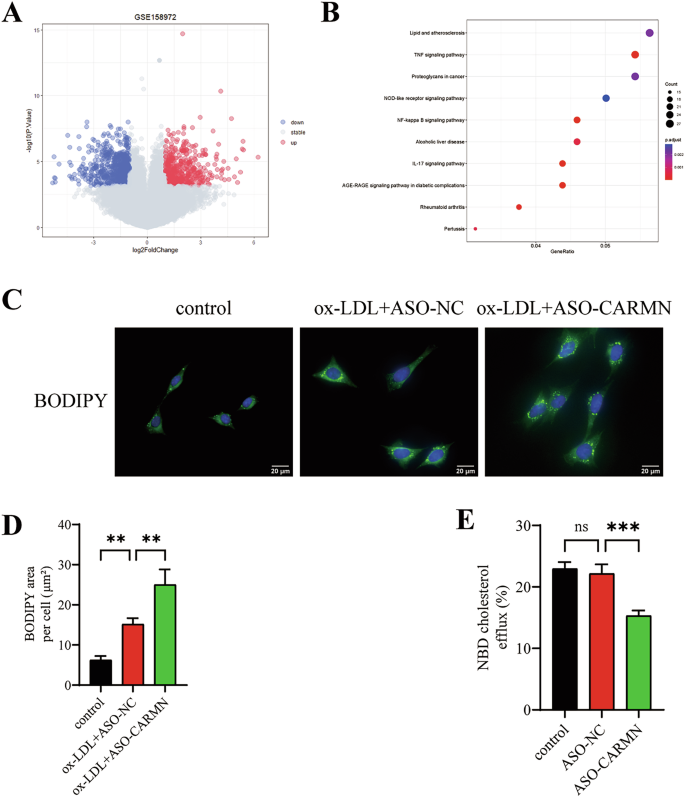 Fig. 2: CARMN knockdown promotes VSMC-derived foam cell formation by inhibiting cholesterol efflux.