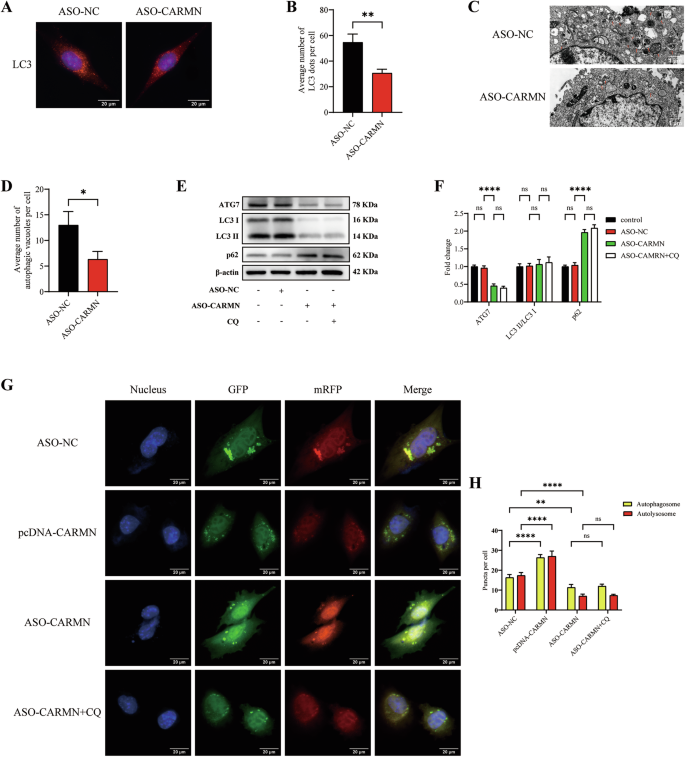 Fig. 3: Knockdown of CARMN transcriptionally downregulates autophagy in VSMCs.