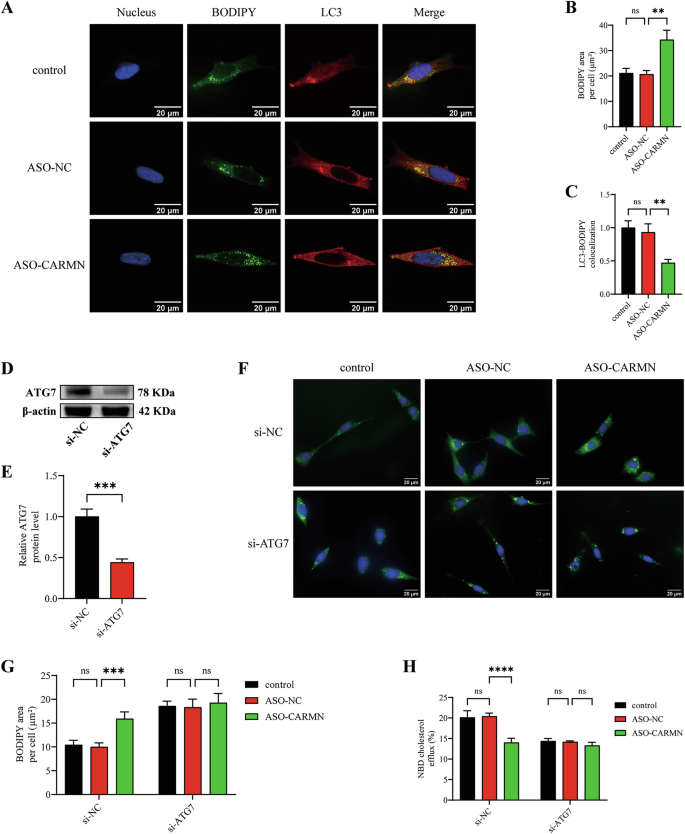 Fig. 4: CARMN knockdown reduces cholesterol efflux and promotes VSMC-derived foam cell formation by regulating autophagy.