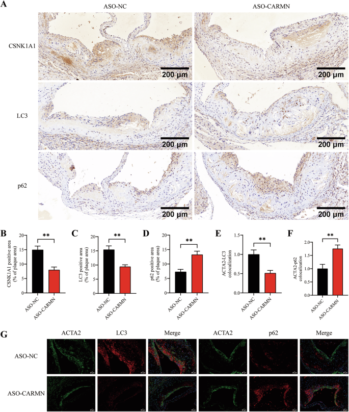 Fig. 8: Silencing CARMN promotes atherosclerosis by regulating autophagy in VSMCs.