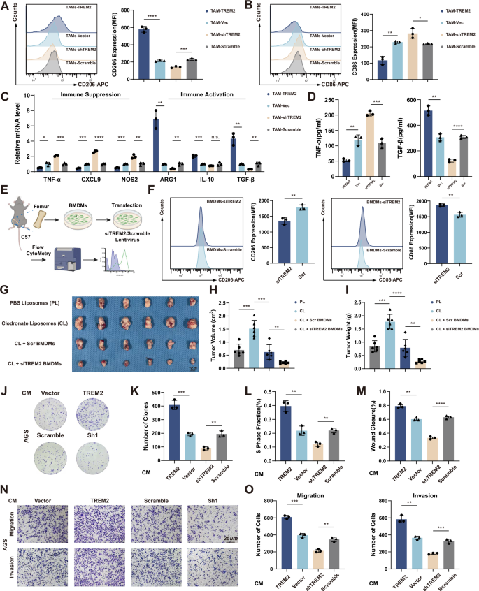 Fig. 2: TREM2 promotes macrophages M2 polarization and GC cell proliferation and migration.