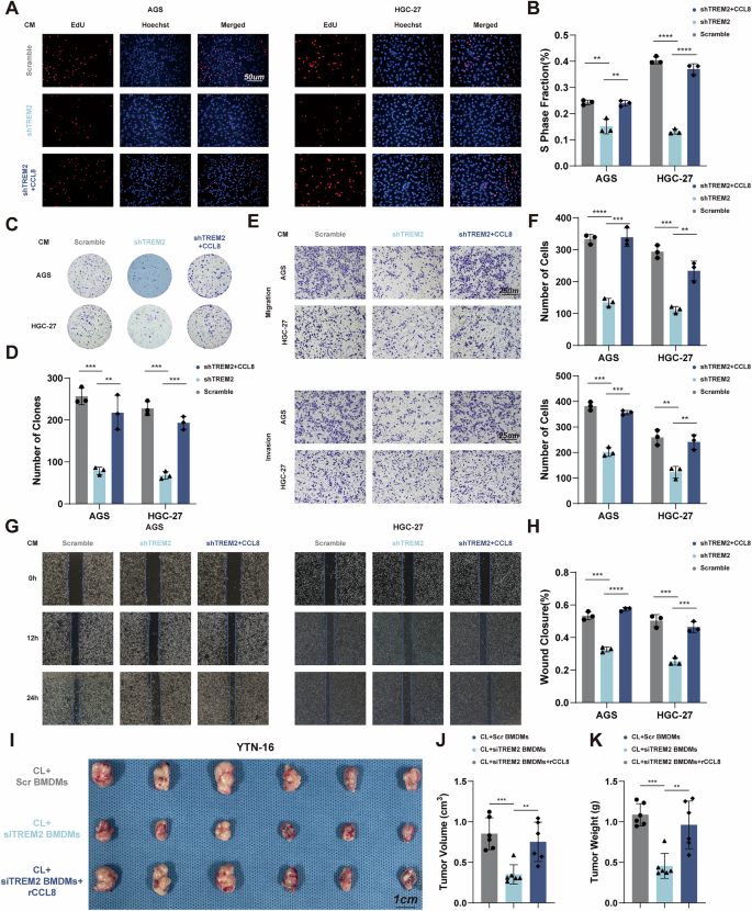 Fig. 4: TREM2+ TAMs promote tumor progression in a CCL8-dependent manner.