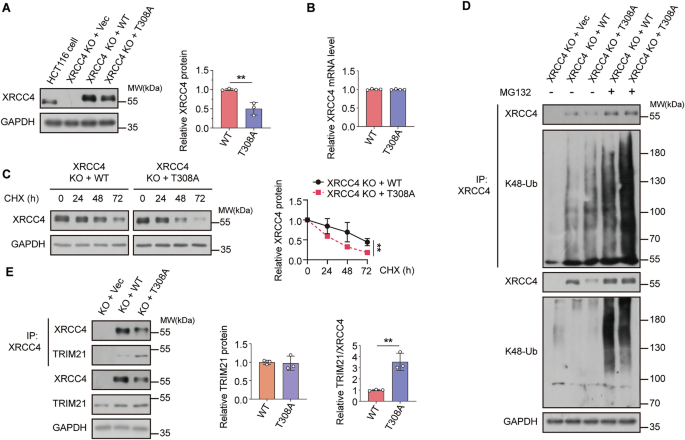 Fig. 5: O-GlcNAc modification of XRCC4 at Thr308 affects cancer cells by blocking its interaction with TRIM21.