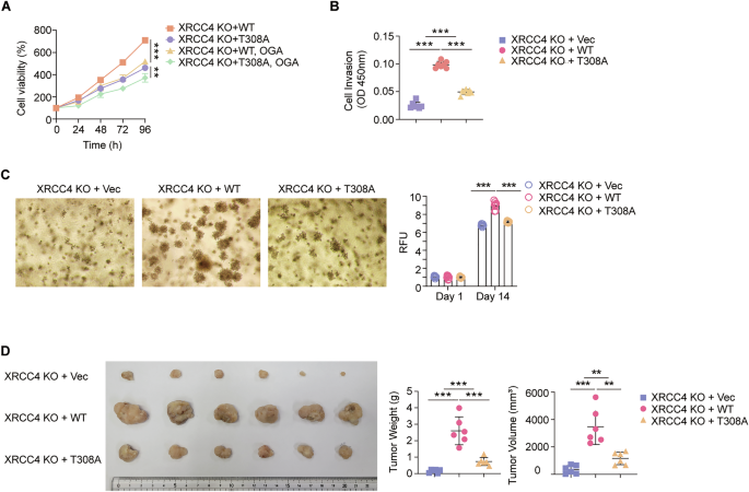 Fig. 7: Thr308 O-GlcNAcylation of XRCC4 promotes cancer cell proliferation, invasion, colony formation, and tumor growth.