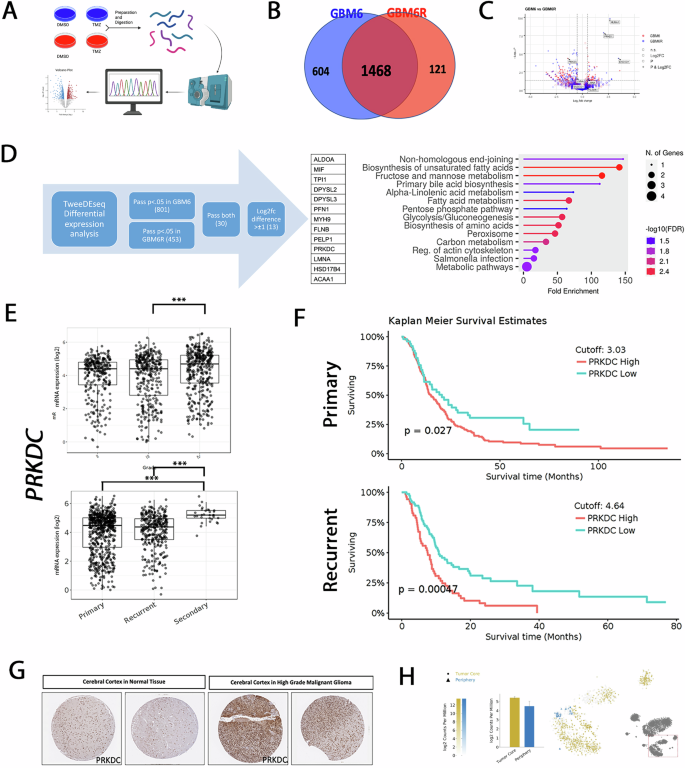 Fig. 2: Unbiased proteomic profiling reveals TMZ-associated upregulation of LMNA and PRKDC in recurrent GBM and their correlation with patient datasets.