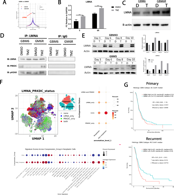 Fig. 4: LMNA expression is induced by TMZ and co-expressed with PRKDC in malignant glioblastoma cells, correlating with poor patient survival.